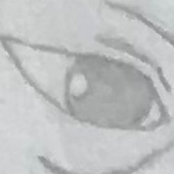 Moro's right eye